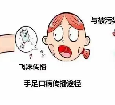 银川市金凤区吉的堡香树幼儿园——【春秋季“手足口病”】知识预防宣传篇