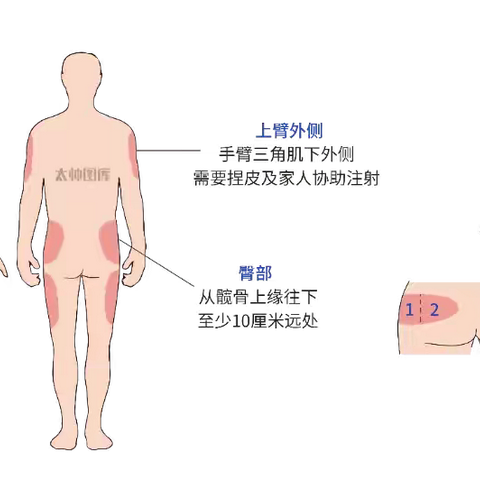 胰岛素常见问题十问十答