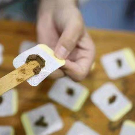 【三九贴】冬病冬治有良方内病外治“三九贴”