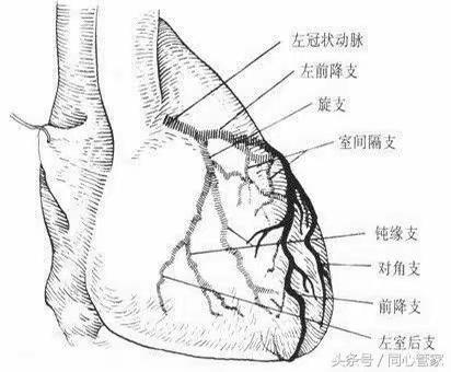 『心血管内科三病区』冠脉造影后注意这4点，可有效减轻痛苦！