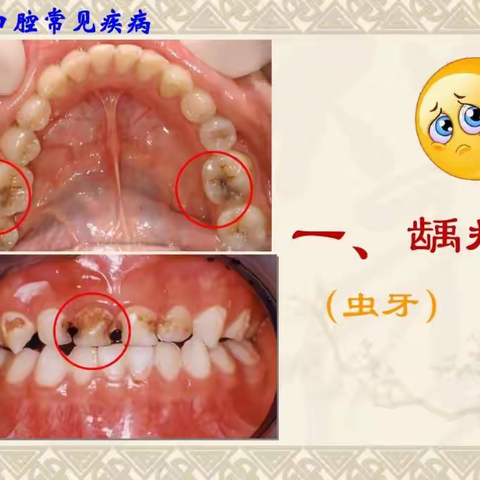 关爱牙齿，从孩子开始