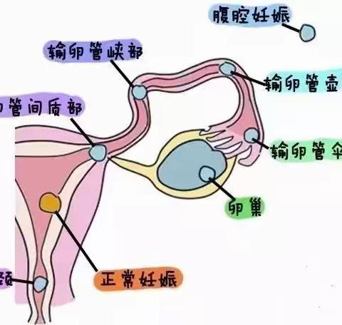 “受精卵”迷路了