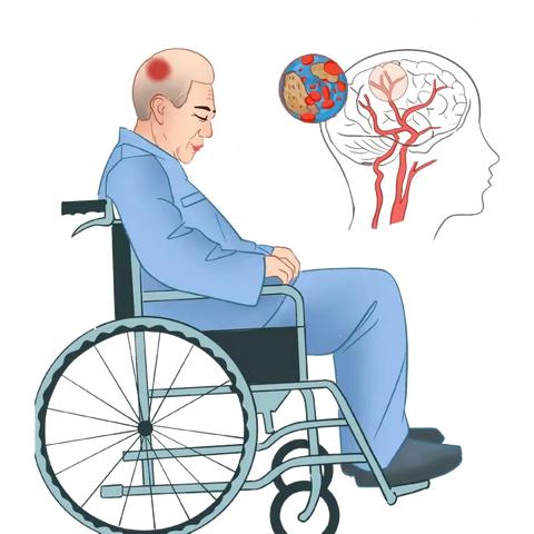 二院科普，气温骤降，脑卒中又到高发期