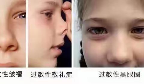 小儿过敏性鼻炎？别慌，试试中医耳穴