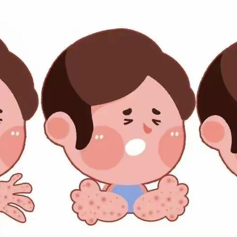 预防手足口病 守护儿童健康——舞阳县🌈金色童年幼儿园手足口病预防知识宣传