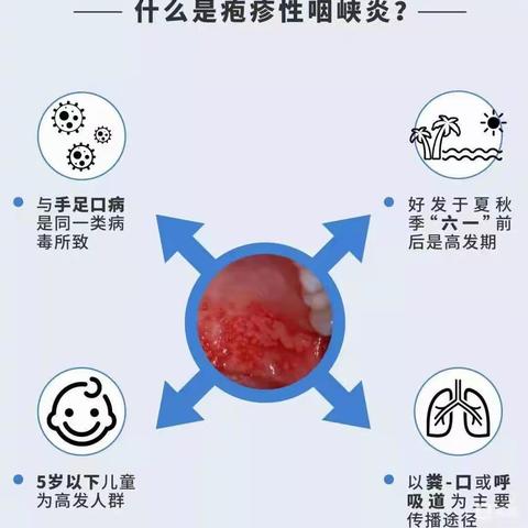 玫瑰楚萌梅林幼儿园          手足口和疱疹性咽颊炎预防小知识