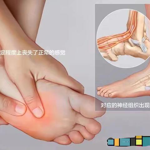 海口市中医院推拿科为你寻找脚麻病因