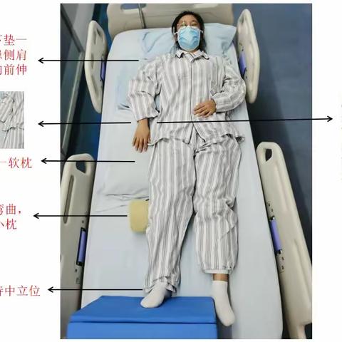 良肢摆放姿势大全