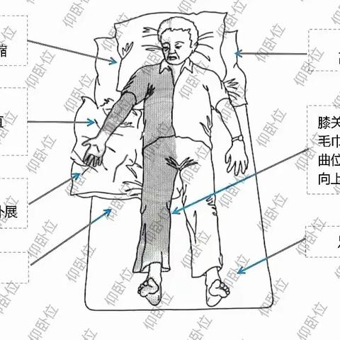 【健康科普】良肢位摆放——卒中后偏瘫患者的必修课