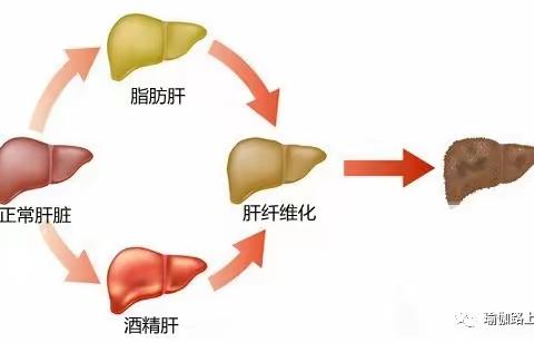 肝 “堵” 会致命，每天 10 分钟瑜伽疏通肝胆经（收藏级）