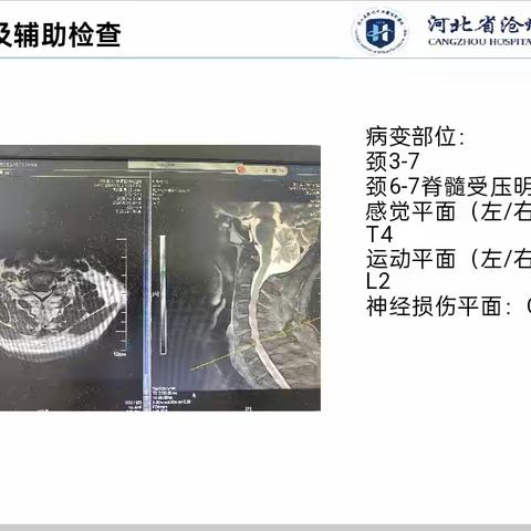 神经源性膀胱患者的康复治疗案例分享