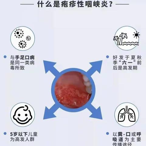 健康宣教 预防先行--实幼府前分园疱疹性咽峡炎防护知识宣传