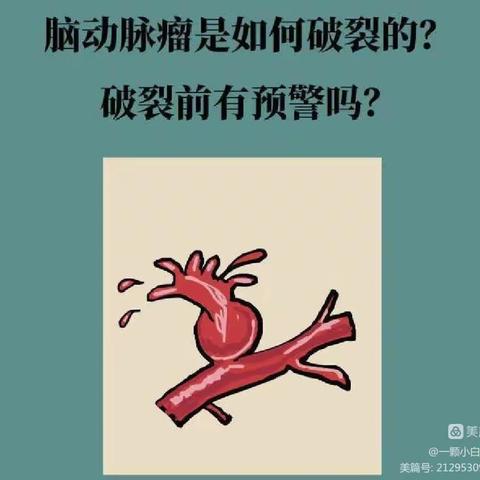 动脉瘤健康教育