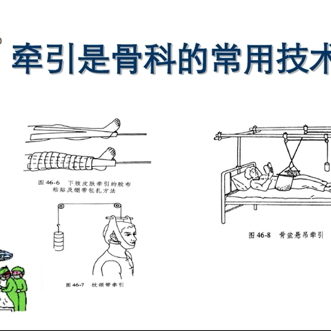 魂“牵”梦绕，“引”人入胜——骨牵引小知识。