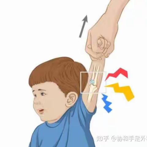 学前儿童运动系统的卫生与保健知识—脱臼