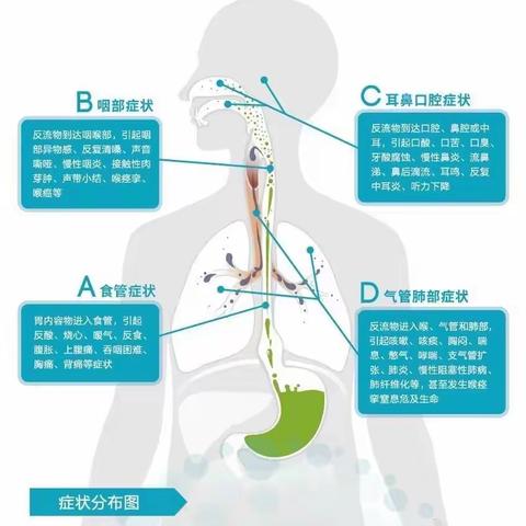 胃食管反流病怎么治？看这篇就够了！