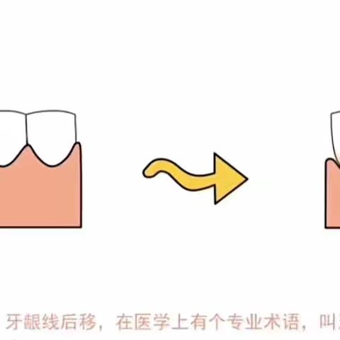 暴露年龄的不只是逐渐后移的“发际线”还有口中的“牙龈线”