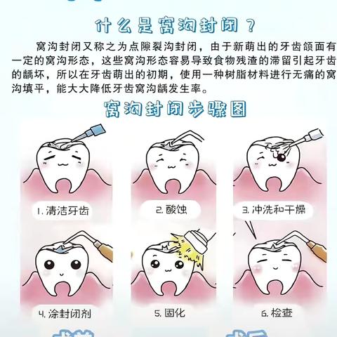 高陵区医院口腔科开展 ‍”关爱儿童口腔健康——六龄齿窝沟封闭公益行动”