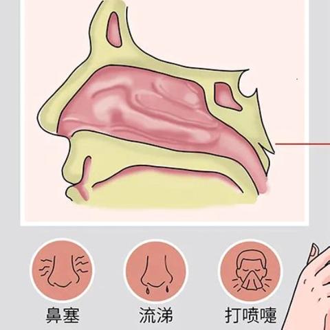 秋季鼻炎大作战，十二技教你胜取！