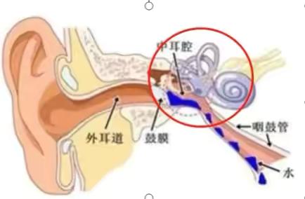 流感高发！孩子喊耳朵疼？当心是急性中耳炎！