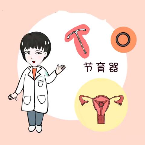 “宫内节育器”你了解多少?