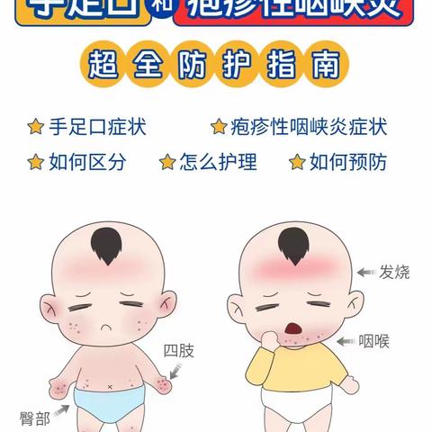 金鹰幼儿园   疱疹性咽颊炎  手足口病预防宣传