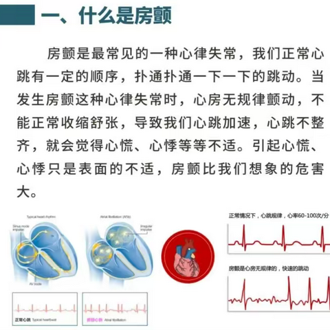 房颤患者用药须知——让你又快又乱的心脏慢下来