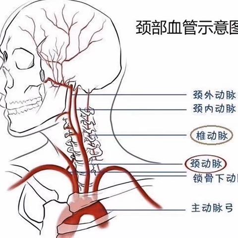 重视颈动脉健康,让“血管杀手”无所遁形