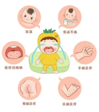 【西安未央芳草嘉和幼儿园】科学预防，健康守护|手足口病与疱疹性咽峡炎预防小知识