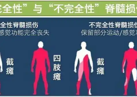 中药怎么样恢复脊髓损伤?