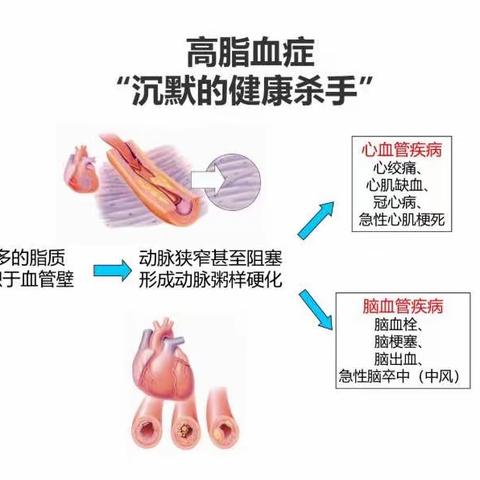 血脂异常怎么吃？