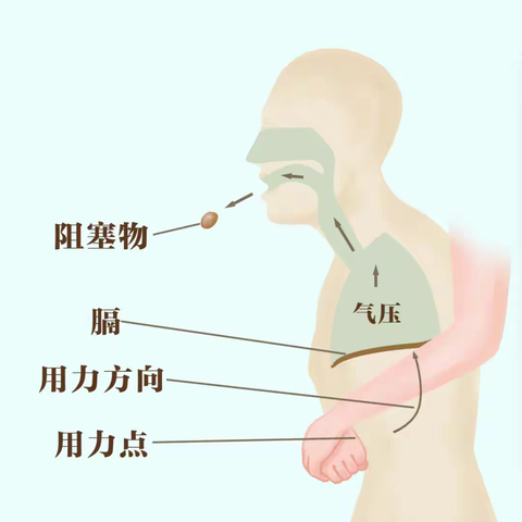 “急”时处置，“救”在身边—— 睦洲镇中心幼儿园寒假安全急救常识手册