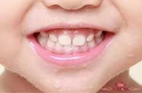 卓维雅口腔早报分享（乳牙明明很齐，为什么换牙后却不齐？）