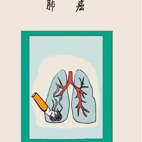 肺癌的健康教育