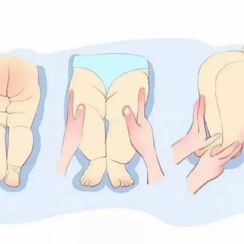 我的髋关节会说话-听，宝宝身体发出的SOS