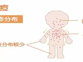 瑞贝幼儿园丨健康知识宣传∶让我们一起做自己健康的第一责任人