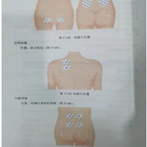 晋华宫社区卫生服务中心中医科特色疼痛治疗