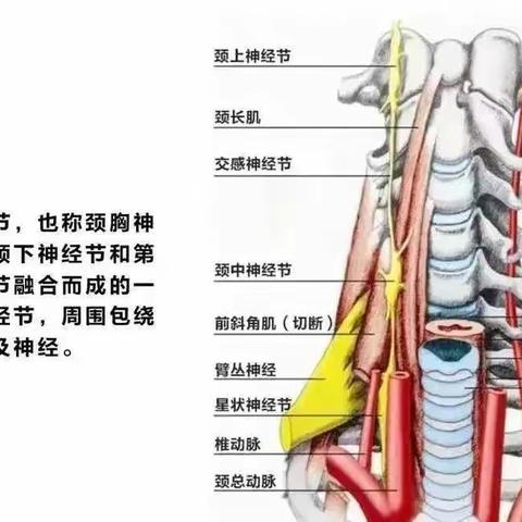 神奇的星状神经节阻滞术