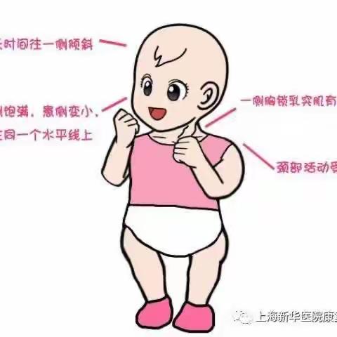 颜值杀手——先天性肌性斜颈