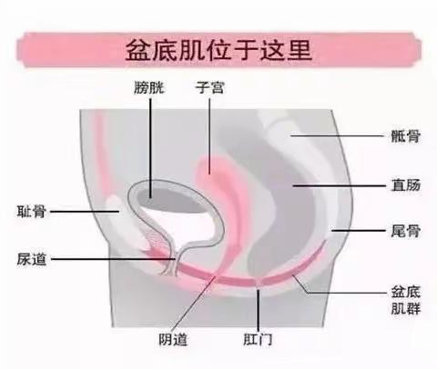 关爱女性健康，从盆底康复开始