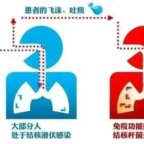 你我共同努力  终结结核流行