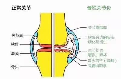 膝关节疼痛到底要不要锻炼？