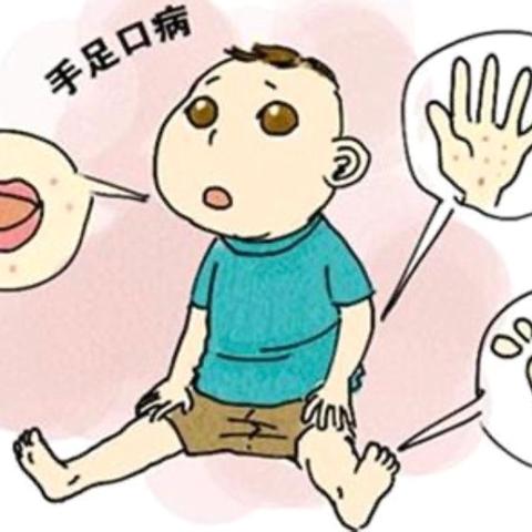 鸿府幼儿园手足口病预防告家长书