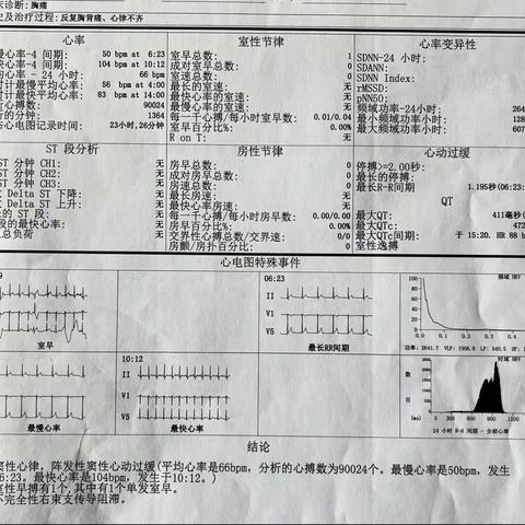 植入式心电事件监测器，心悸查因小侦探