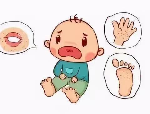 儿童手足口病的防治及居家护理