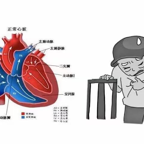 慢性心功能不全的健康指导