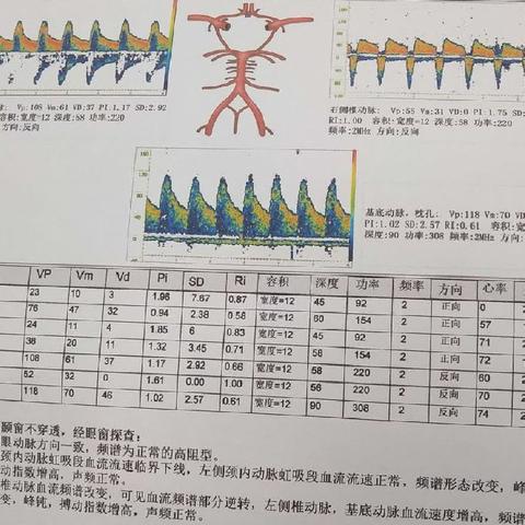 经颅多普勒的世界。