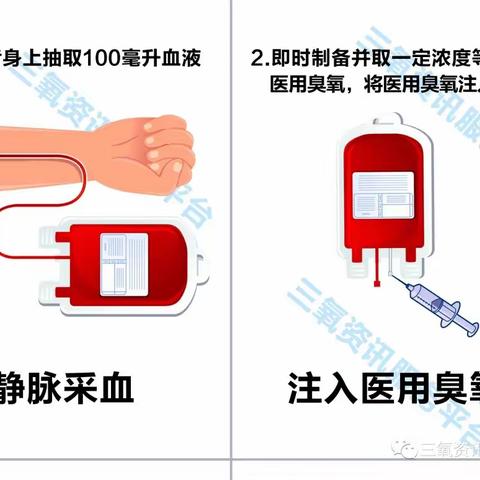 三氧疗法可以治疗静脉曲张啦！