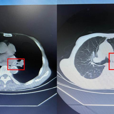 妙手取“物”，有“镜”无险……