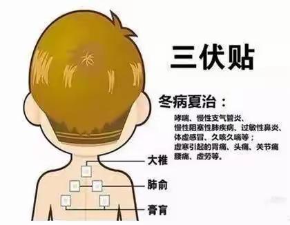 光明城社区卫生服务站“三伏贴”开始预约啦！